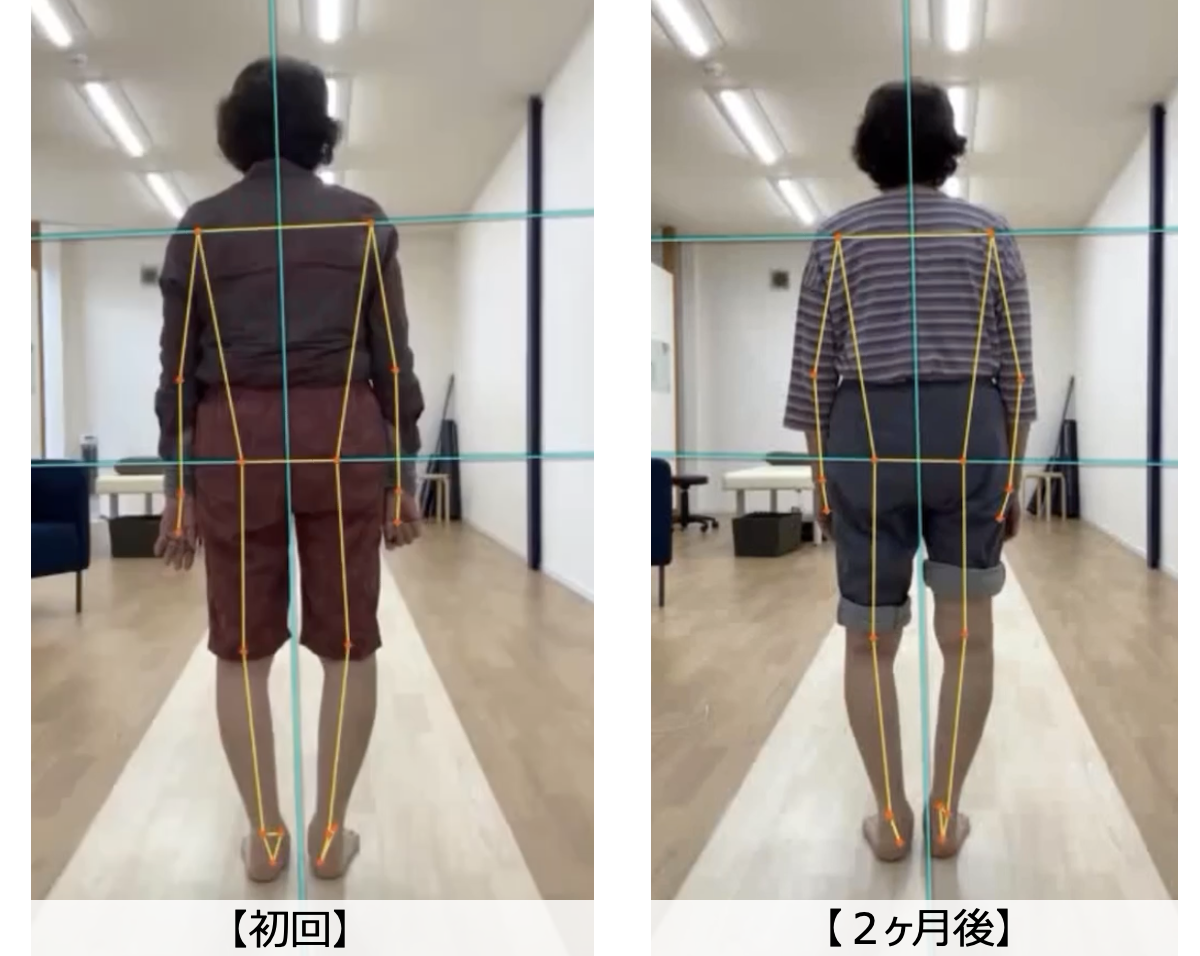 【AIによる歩行分析】歩きや姿勢を伝わりやすくお伝えします。